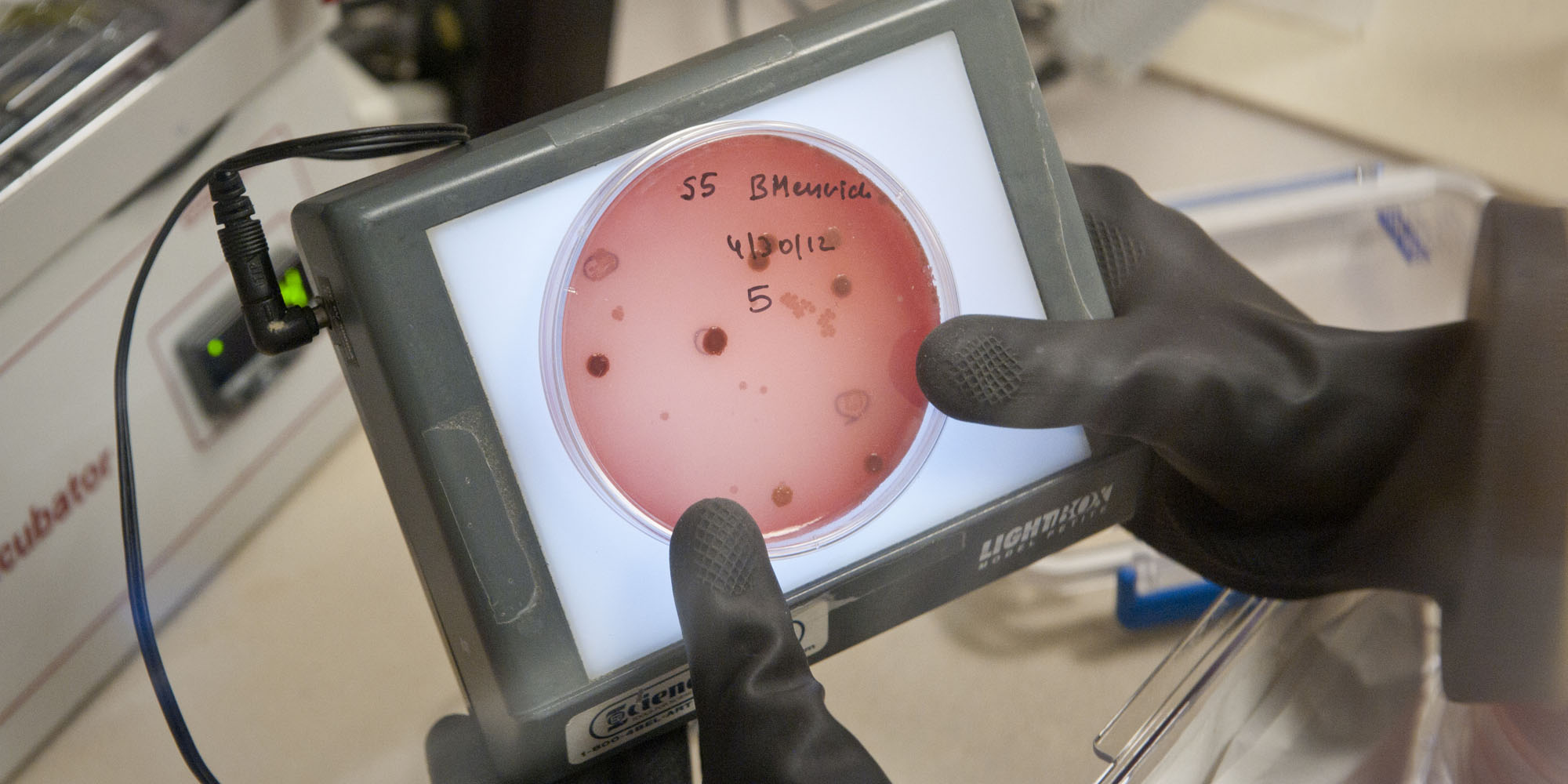 bacteria on screen