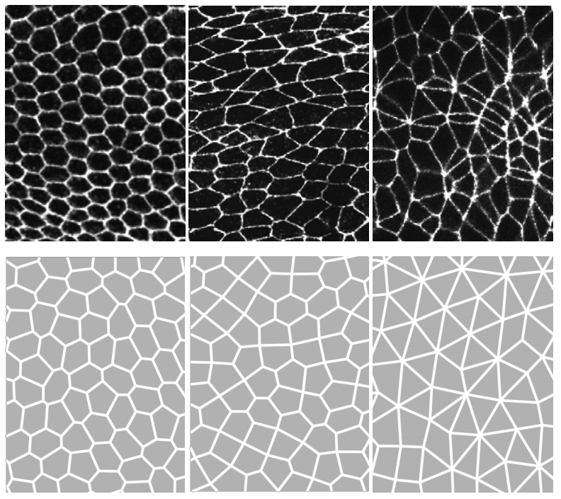 Top row: A transition from normal epithelial cells in a honeycomb pattern (top left) to shifted cells. This transition leads to increasing disorder in their shapes. Bottom row: Simulated patterns from the theoretical vertex model recapitulate cell shapes and topologies.