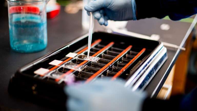 Emma Robinson’s co-op experience at Harvard Medical School leads her to pursue a PhD.