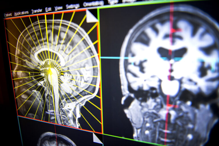 College of Science Connects: The Plastic Brain; Injury and Repair