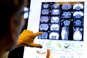 close up of hand pointing to blue and purple brain scan images