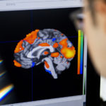 an image of a brain scan appears on a computer