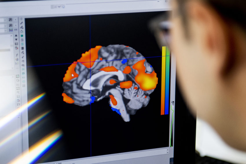 an image of a brain scan appears on a computer