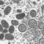 black and white photo of the virus monkey pox under a microscope