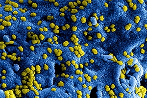 close up of a virus that is blue and yellow