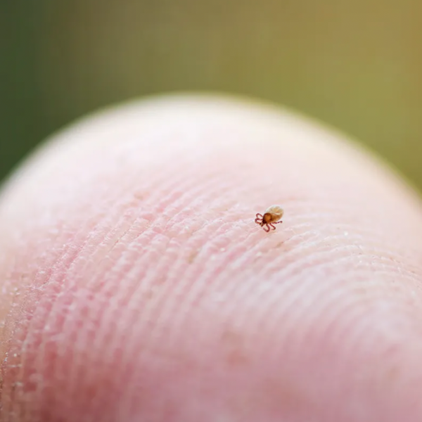Extreme close up of a finger tip with a near microscopic tick barely visible on top