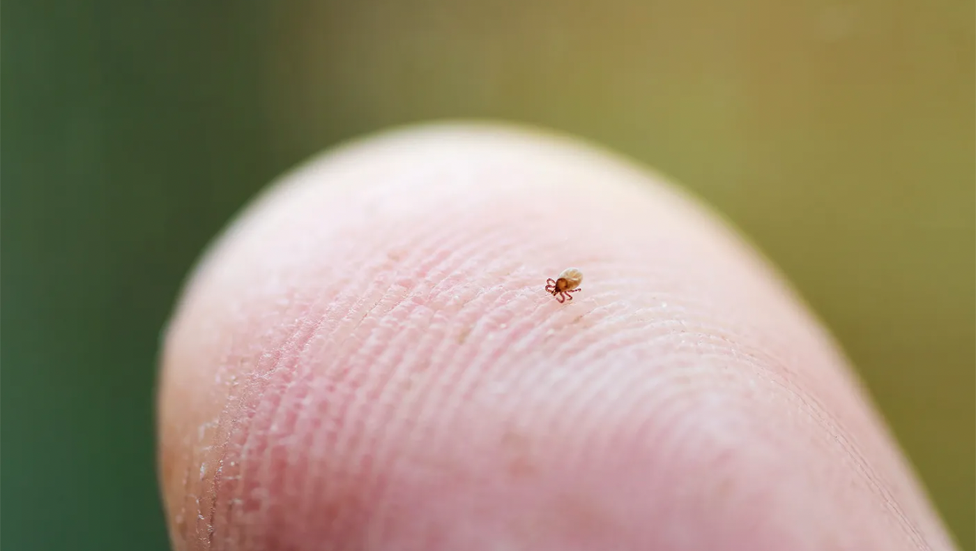 Extreme close up of a finger tip with a near microscopic tick barely visible on top