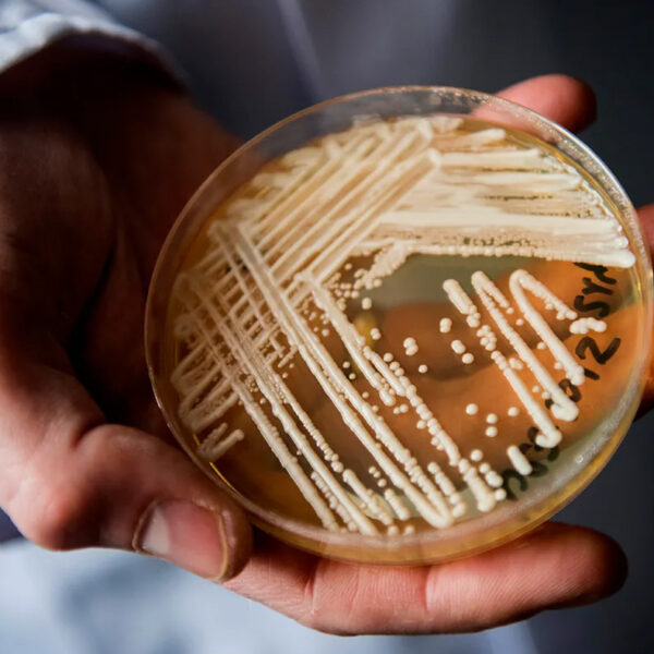 Petri dish of yeast candida auris
