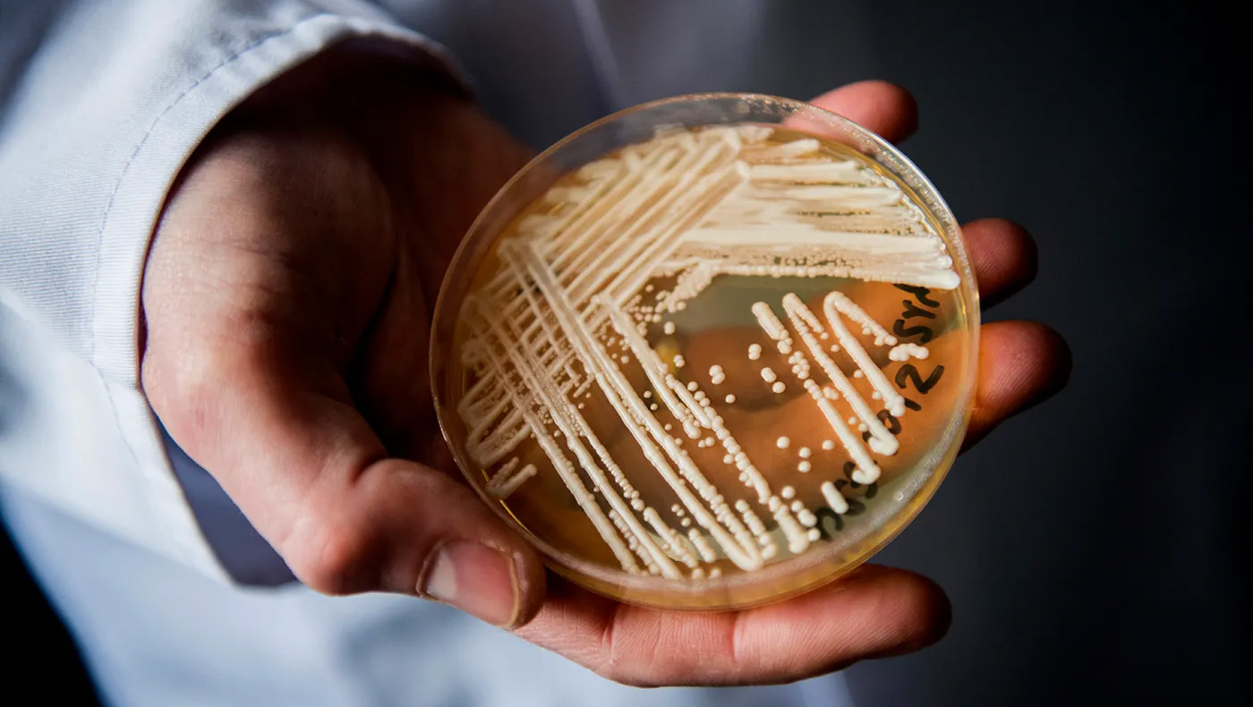 Petri dish of yeast candida auris