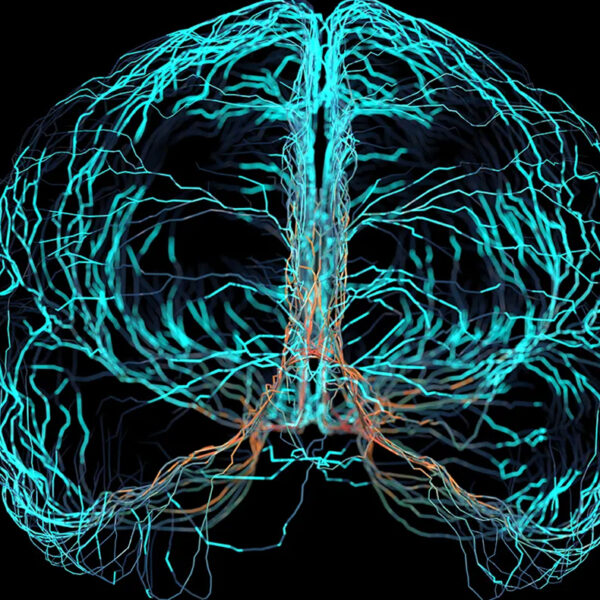 Brain Scan in Blue